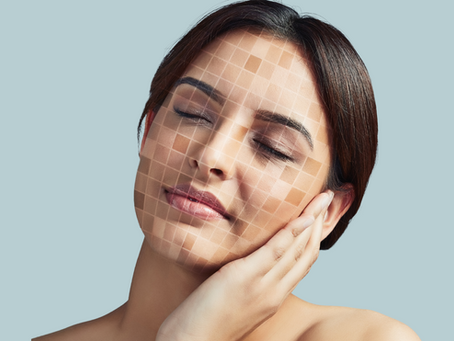 Say Goodbye to Uneven Skin Tone: Understanding & Treating Skin Discoloration