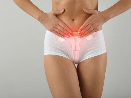 Endometriosis: What is it?