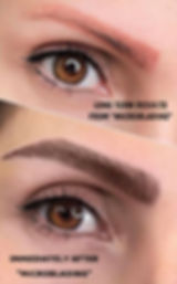 Microblading longterm health of skin