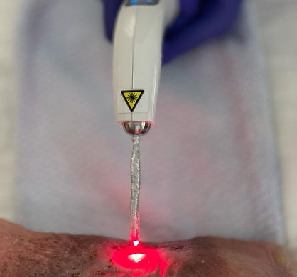 Laserterapia Riomafra