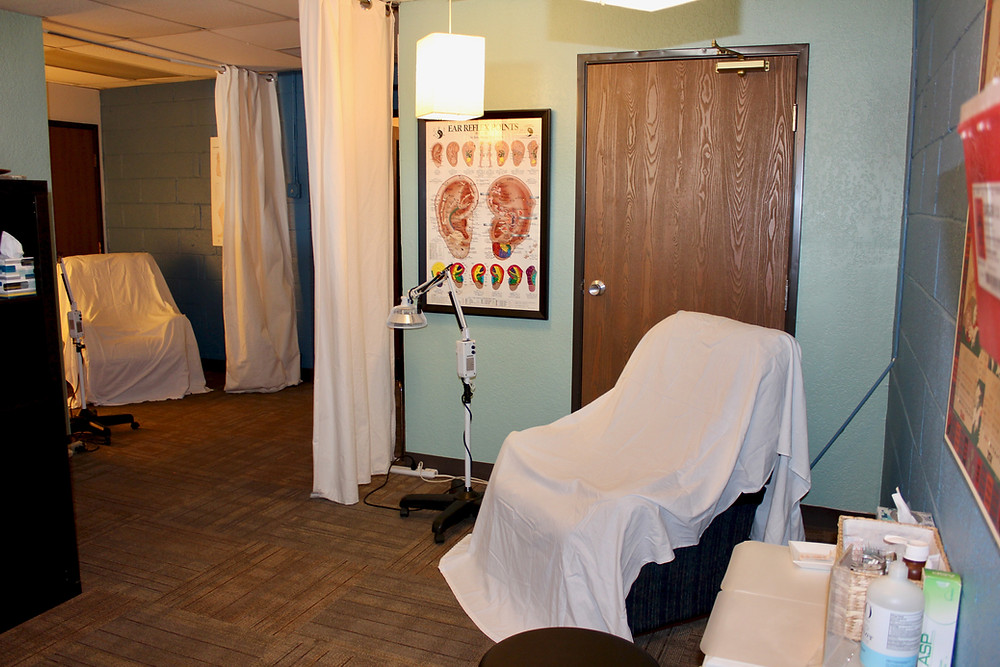 Acupuncture for Pain in Denver: Visit Denver Community Acupuncture