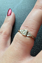 A ring that is too tight on a ladies hand