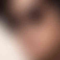 Lindberg eyeglasses on model