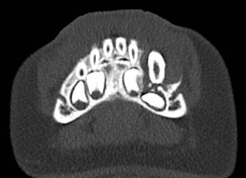 PH56046-19.jpg