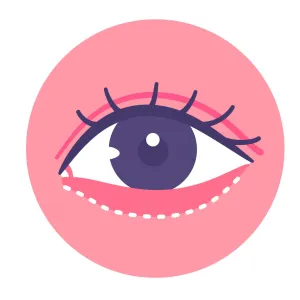 Unterlidstraffung-.webp