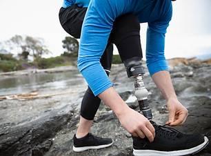 Runner with Amputated Leg