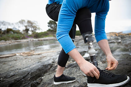 Runner with Amputated Leg