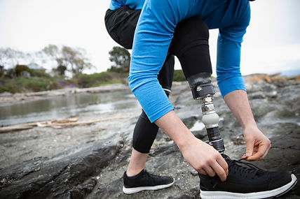 Runner with Amputated Leg