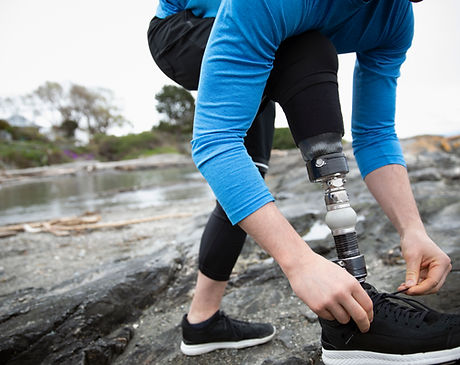 Coureur avec une jambe amputée 