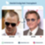 Daniel Craig Hair transplant