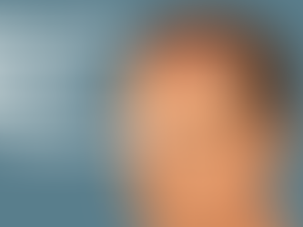 What Are Scabs After Hair Transplant?