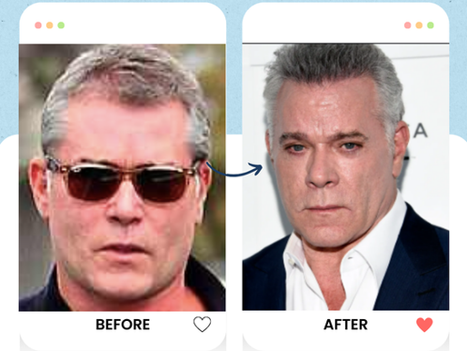 Ray Liotta Hair Transplant