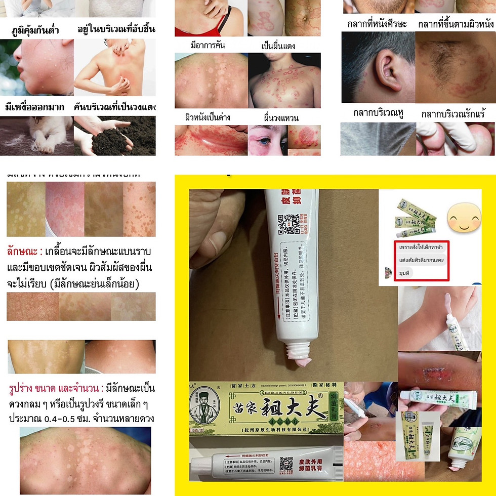 ภาพขนาดย่อ: สมุนไพรจีนยาแก้คันBKครีม4หลอด300บาท