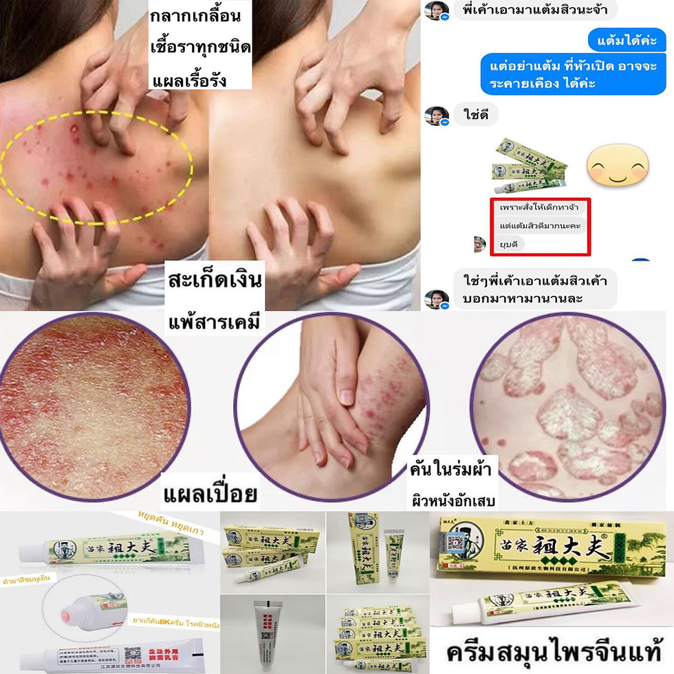 ภาพขนาดย่อ: สมุนไพรจีนยาแก้คันBKครีม1หลอด120บาท