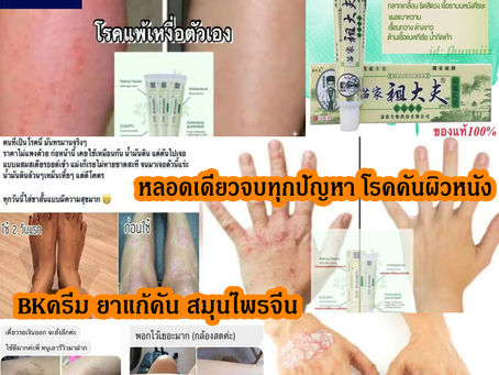 ฺBKครีม แก้อาการคัน