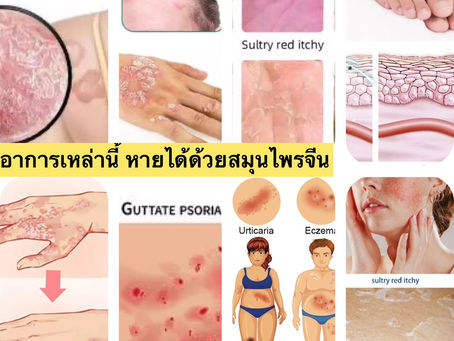 ยาแก้คัน สมุนไพรจีน bkครีมแก้คัน