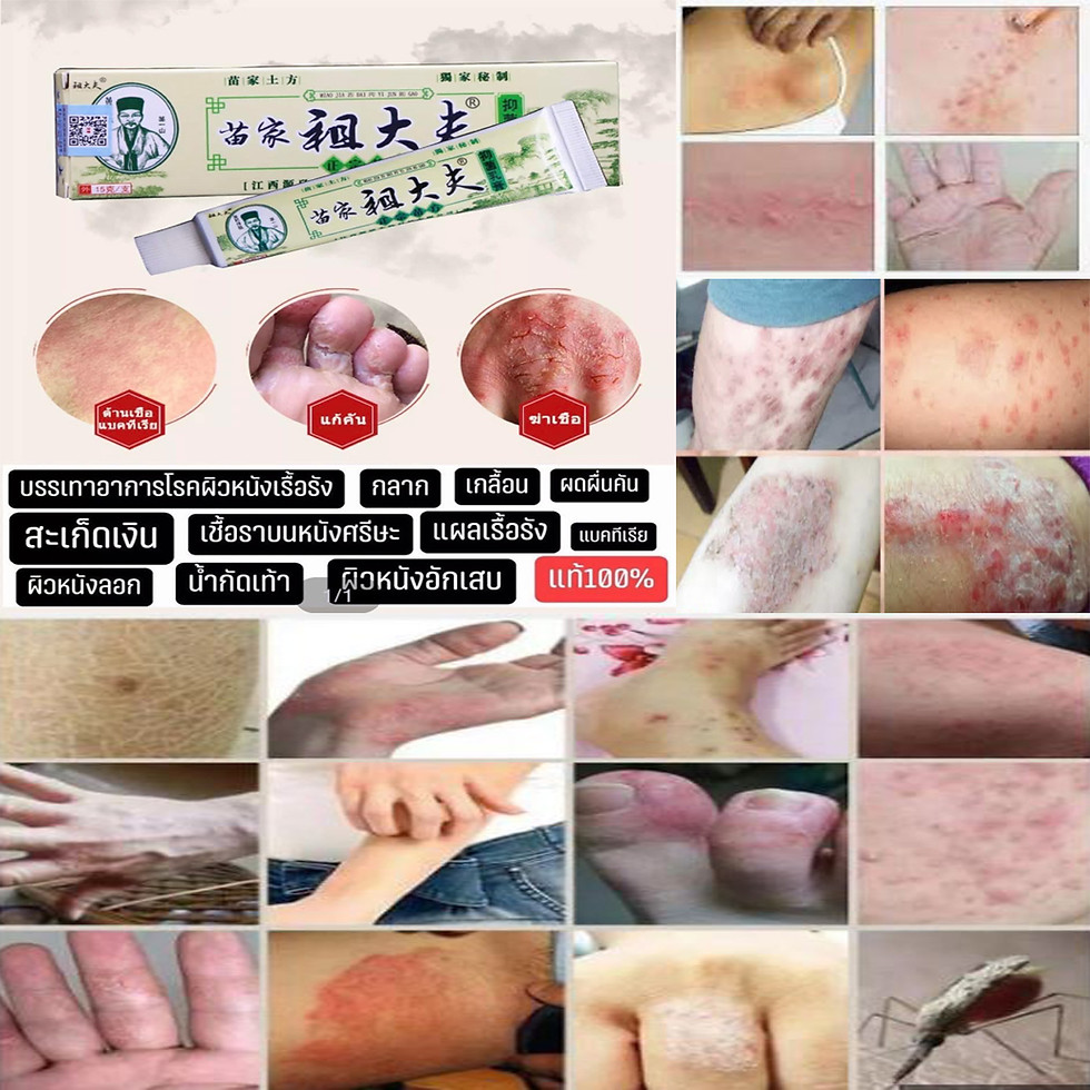 ภาพขนาดย่อ: สมุนไพรจีนยาแก้คันBKครีม1หลอด120บาท