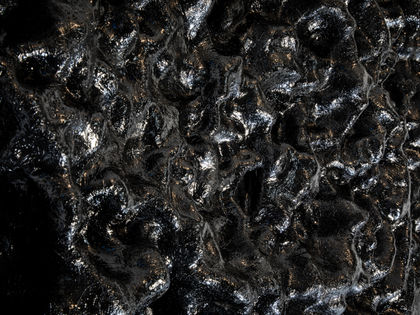 Sebastião Lobo, "Cerebral Cysticercosis"