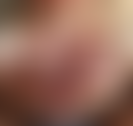 Comprender el TOC posparto y los pensamientos intrusivos: un enfoque de psiquiatría integradora.