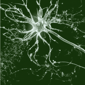 Alzheimer's Under the Microscope: Why Long Held Theories Are Losing Ground