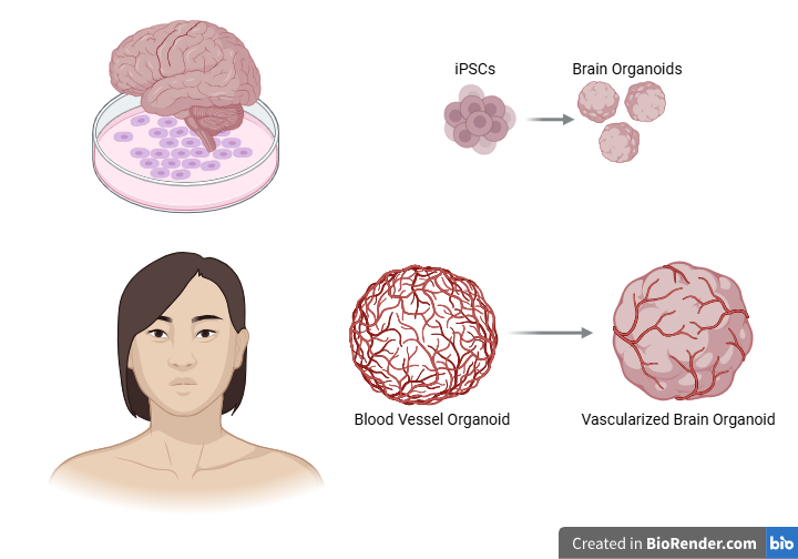 Brain and blood vessel organoids combined to form a vascularized brain organoid. Created in BioRender.