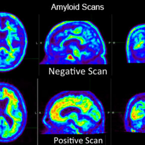 Longevity Talks: How Can We Come Face-To-Face With Our Age