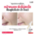 ภาพขนาดย่อ: CosMD 15% Vitamin C + Ferulic Acid High-Potency Antioxidant Brightening Serum