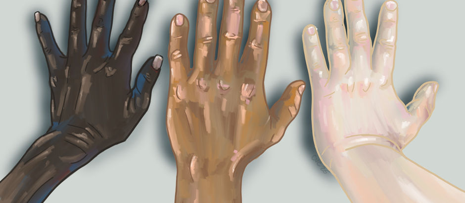 Pulse oximetry sensors on diverse skin tones illustrating variability in SpO₂ accuracy.