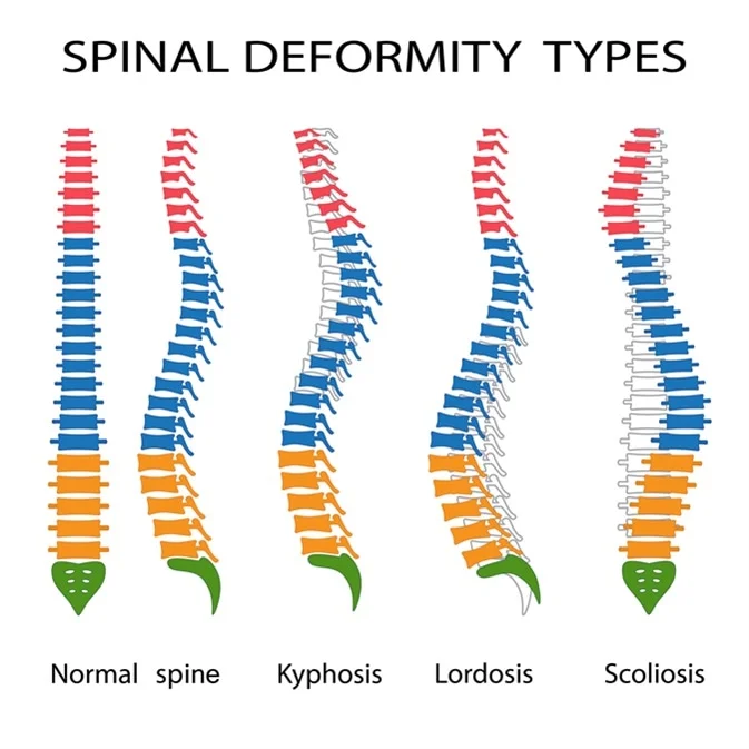 spine picture.webp