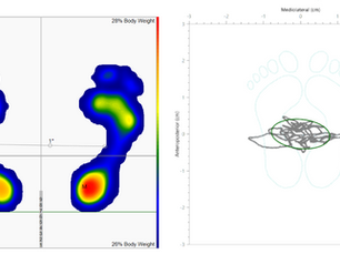 What is the difference between force platforms and pressure platforms?