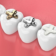 dental white filling