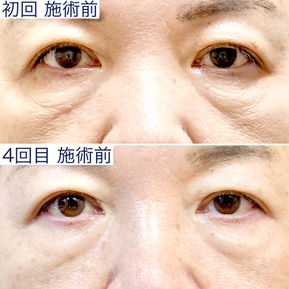 もう、手術しかない？