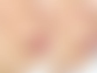 50代目前のたるみケア、今すぐ始めた方が良い理由