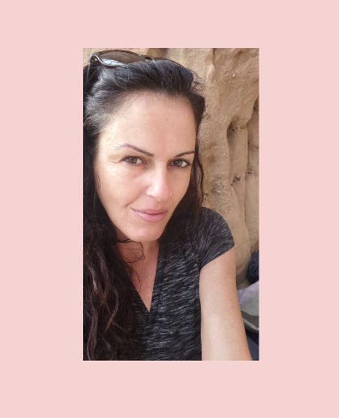 טל אורטס אימון לייזר