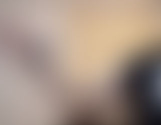 腕で見る山鹿・治らない骨折