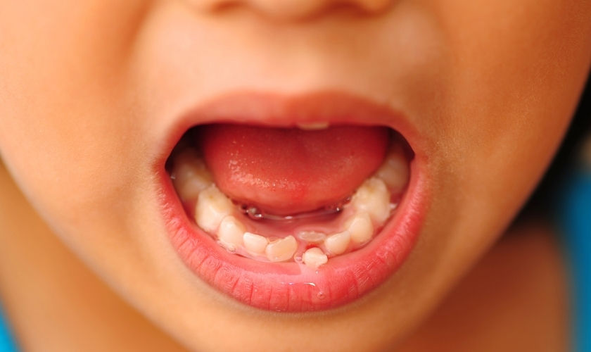 Pushing Boundaries and Pulling Teeth 