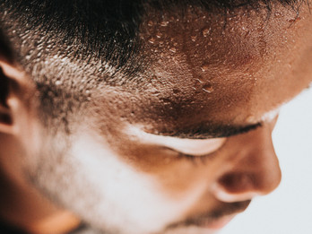 excessive sweating