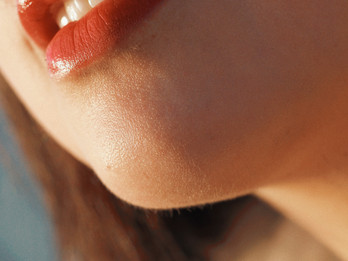 cold sore