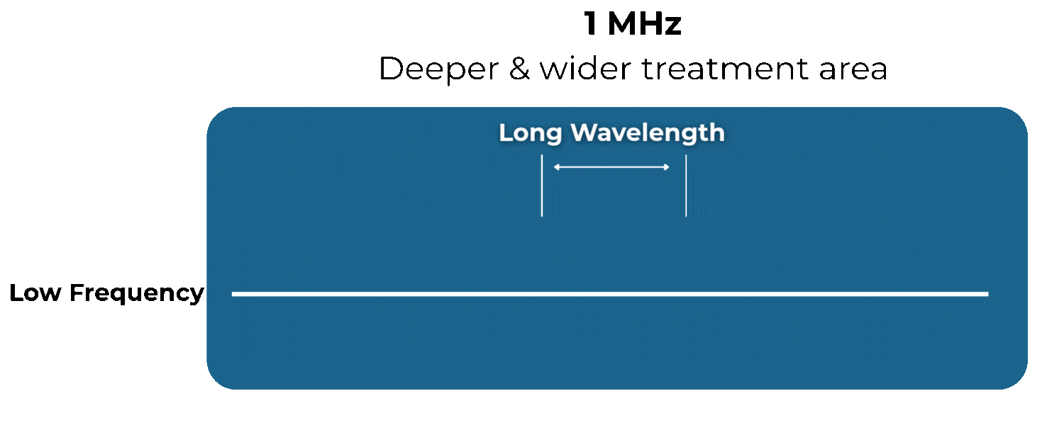1 MHz explained 2.gif