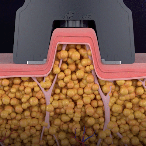 Automatic Drainage effect through a Vacuum