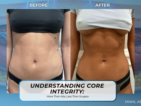 Understanding Core Integrity: More Than Abs, Less Than Surgery