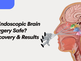Is Endoscopic Brain Surgery Safe? Recovery & Results