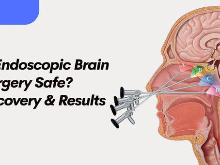 Is Endoscopic Brain Surgery Safe? Recovery & Results
