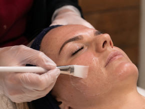 Close-up of Lacey applying a professional chemical skin peel to a client’s face during a personalised skin treatment at Luminous Skin in Richmond, Nelson.