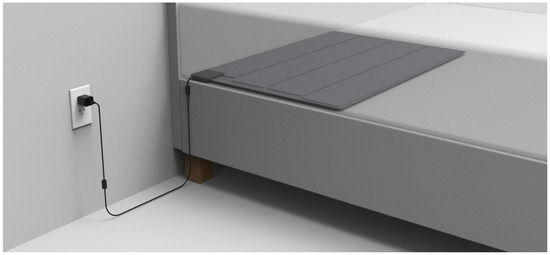 Application and set-up of the SMART MAT.
