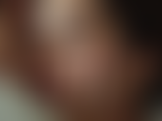 Eye-level view of a person receiving an overwhelming amount of affectionate attention