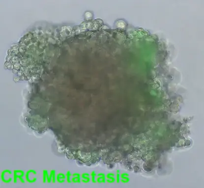 Lung Tumor Organoid_Fluor_cropped_labeled.webp