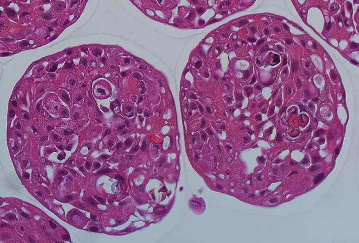 Lung Organoid_H&E_cropped.webp