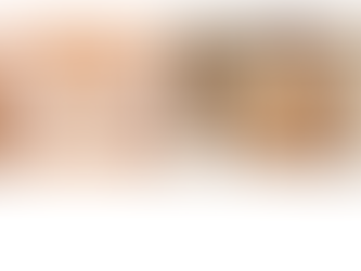 Part 2: The Breakthrough – How We Finally Cracked the Bra Clasp Design