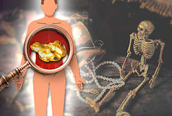 There is gold in the human body. No, really!